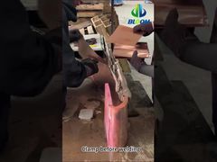 đồng niêm mạc shunt-vertical